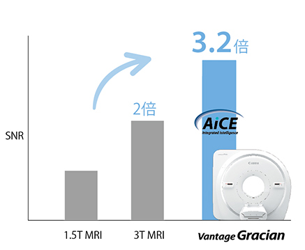 SNR比較グラフ：1.5T MRI、3T MRI（2倍）、Vantage Gracian（3.2倍）